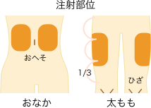 注射部位